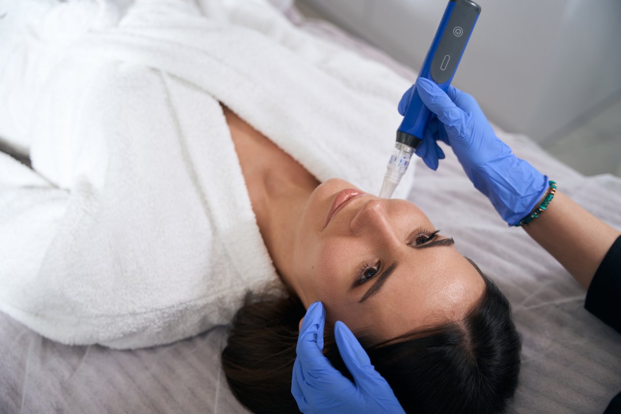 Microneedling handheld device treatment
