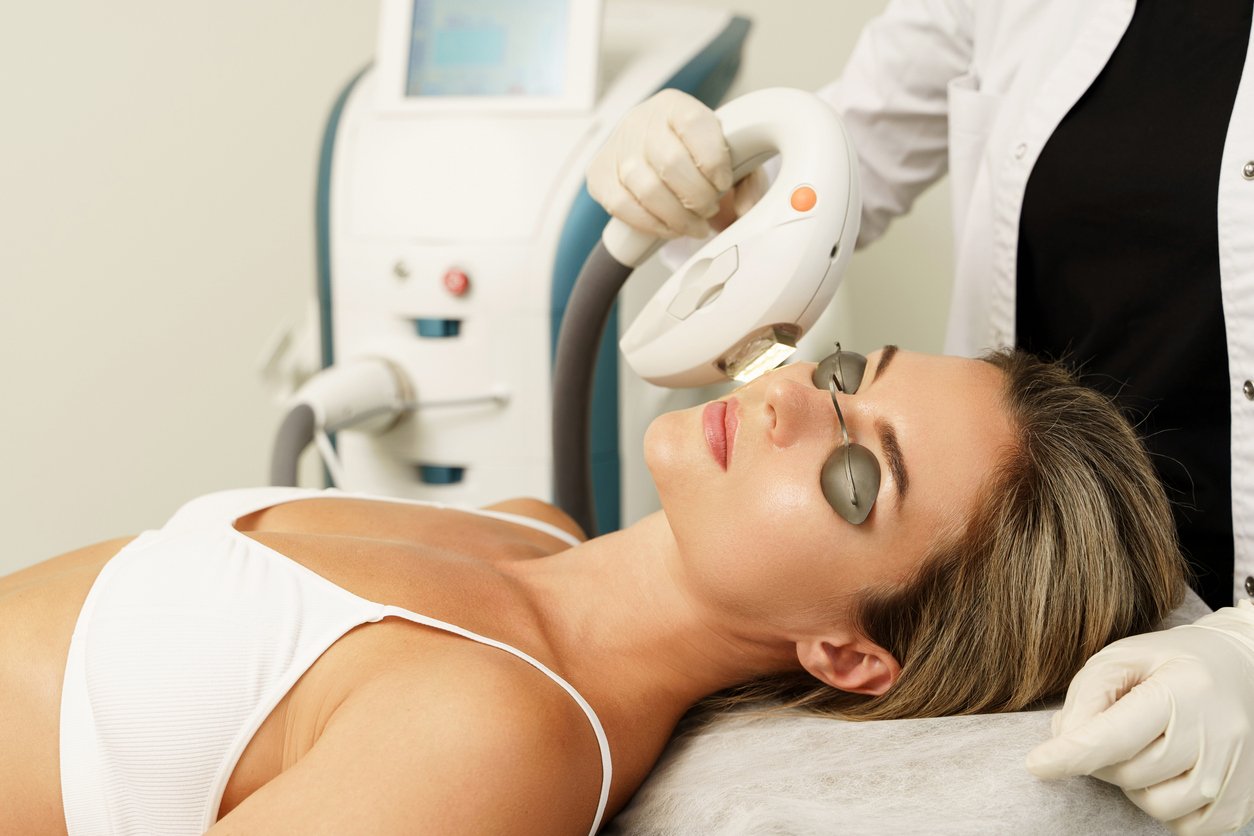 IPL photofacial in progress